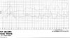 Grease_Chart-R.jpg Grease_Chart-R.jpg